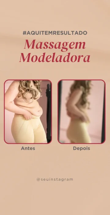Stories para Estetica Corporal (7)